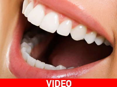 Λεύκανση δοντιών στο σπίτι